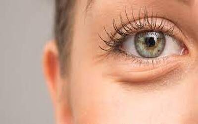 Wake Up Refreshed: 5 DIY Remedies to Instantly De-Puff Eyes